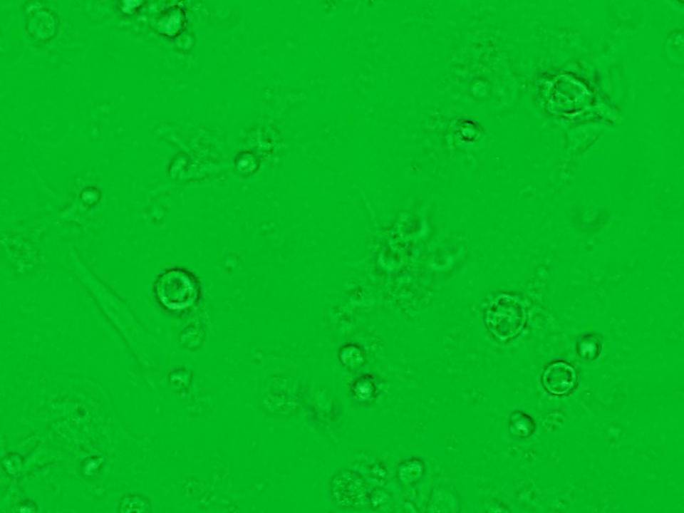 NEPA21 / Primary - Mouse Microglia cells - Viability 65 per cent